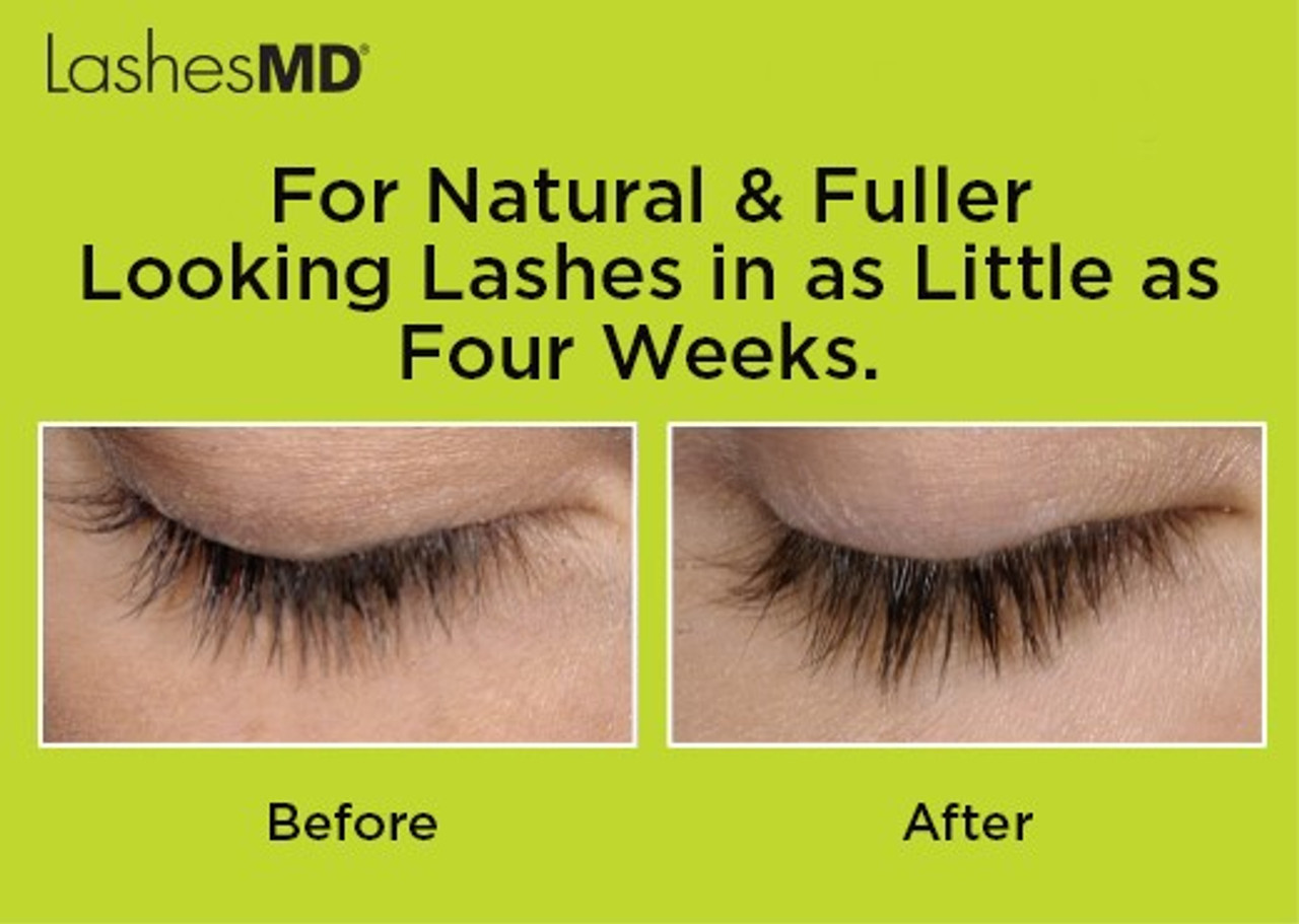 LashesMD_Before_After__09571